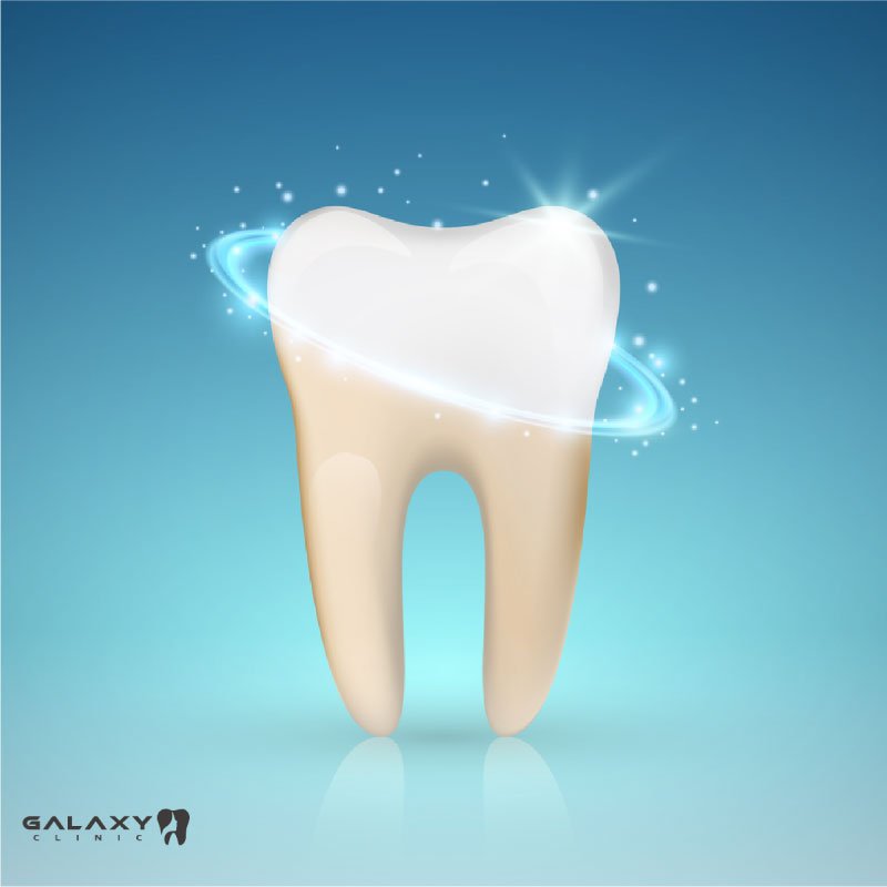 Tooth Whitening Galaxy Clinic Dent