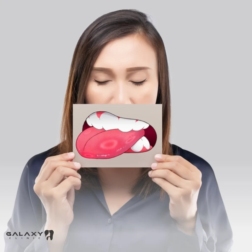 6 symptoms of Painful Mouth Ulcers - Galaxy Clinic dent